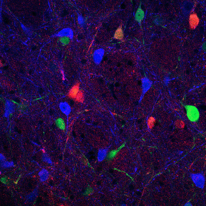 Frootloops in the brain